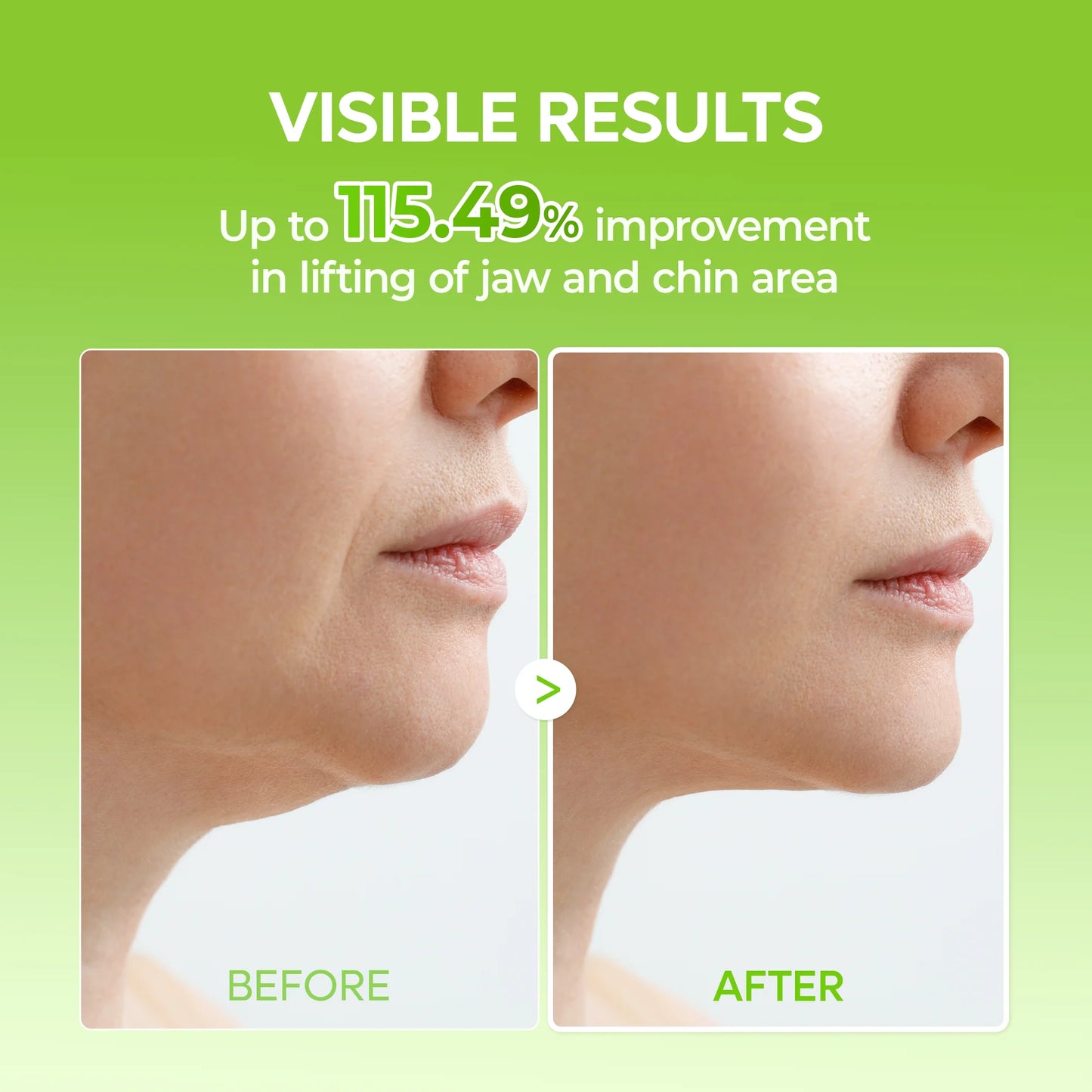 CACTOX V-Lifting Mewing Band
