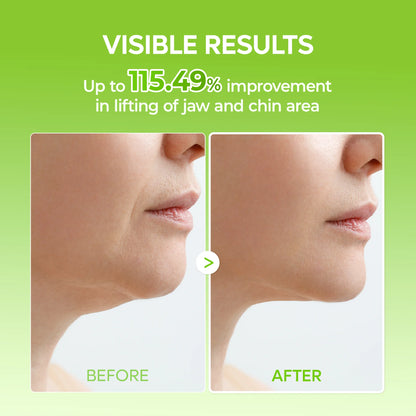 CACTOX V-Lifting Mewing Band