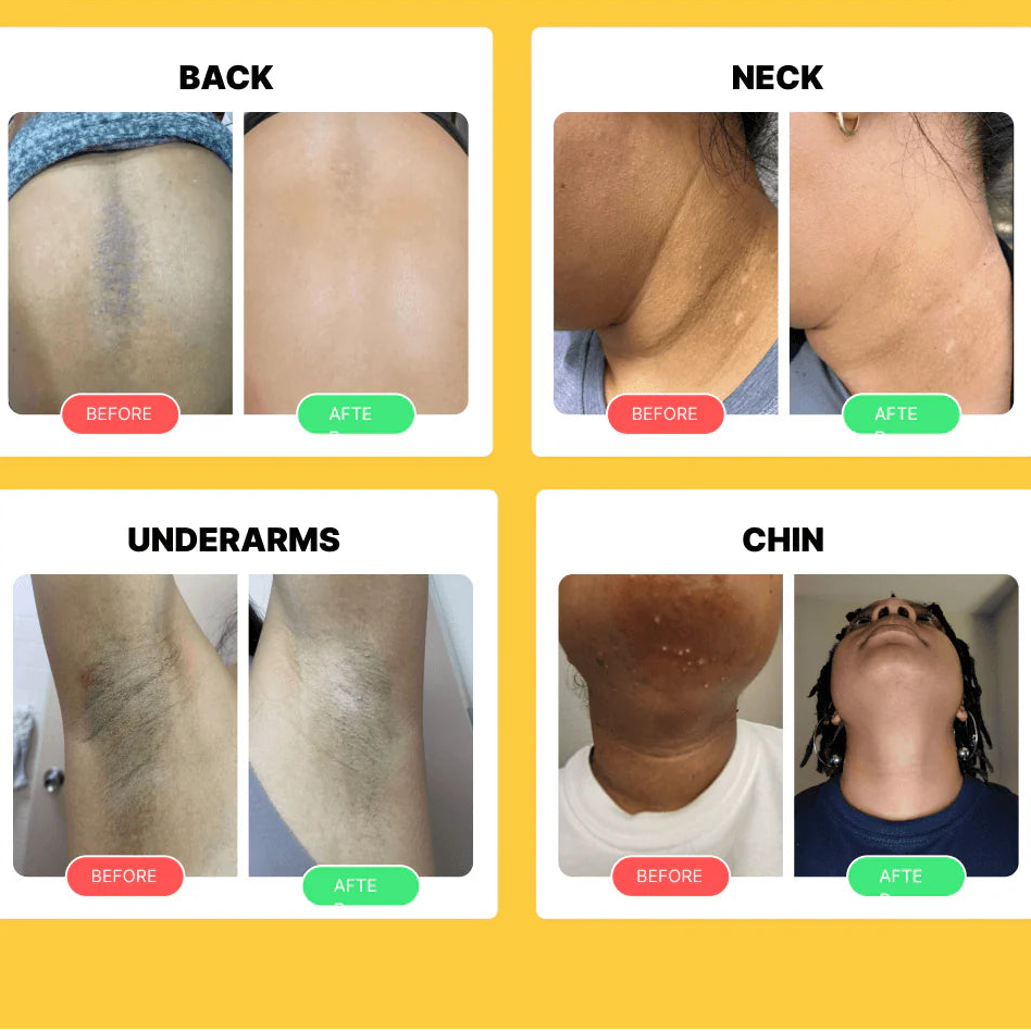 Turmeric Kojic Acid Pads (40pcs)