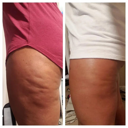 Anti-Cellulite Oil